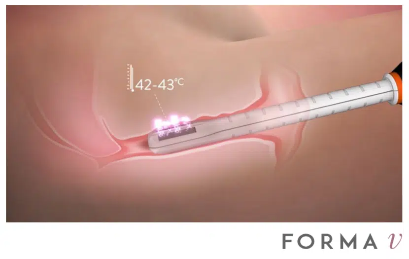 A picture of an image with the words " fortis ".