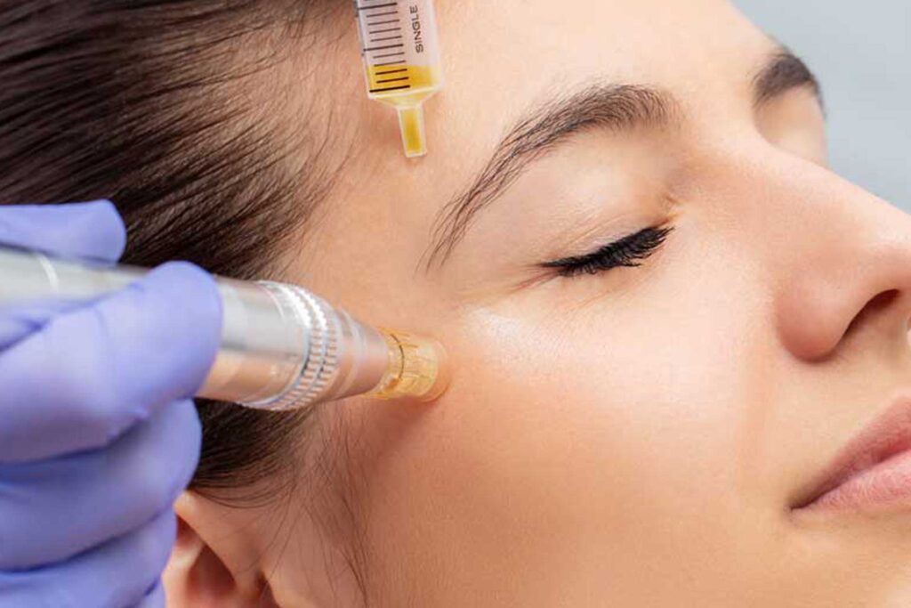 A woman getting her face waxed with an electric device.