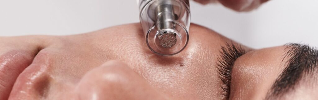 A person is getting their skin examined by an ophthalmoscope.